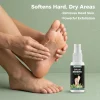 Foot Callus Remover Spray (1 Pack)