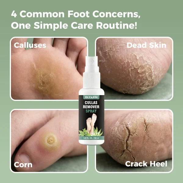 Foot Callus Remover Spray (1 Pack)